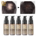 PURC 5pcs Hair Growth Oil for Thinning Hair Ginseng Ginger Prevent Hair Loss Serum Scalp Treatments Hair Care